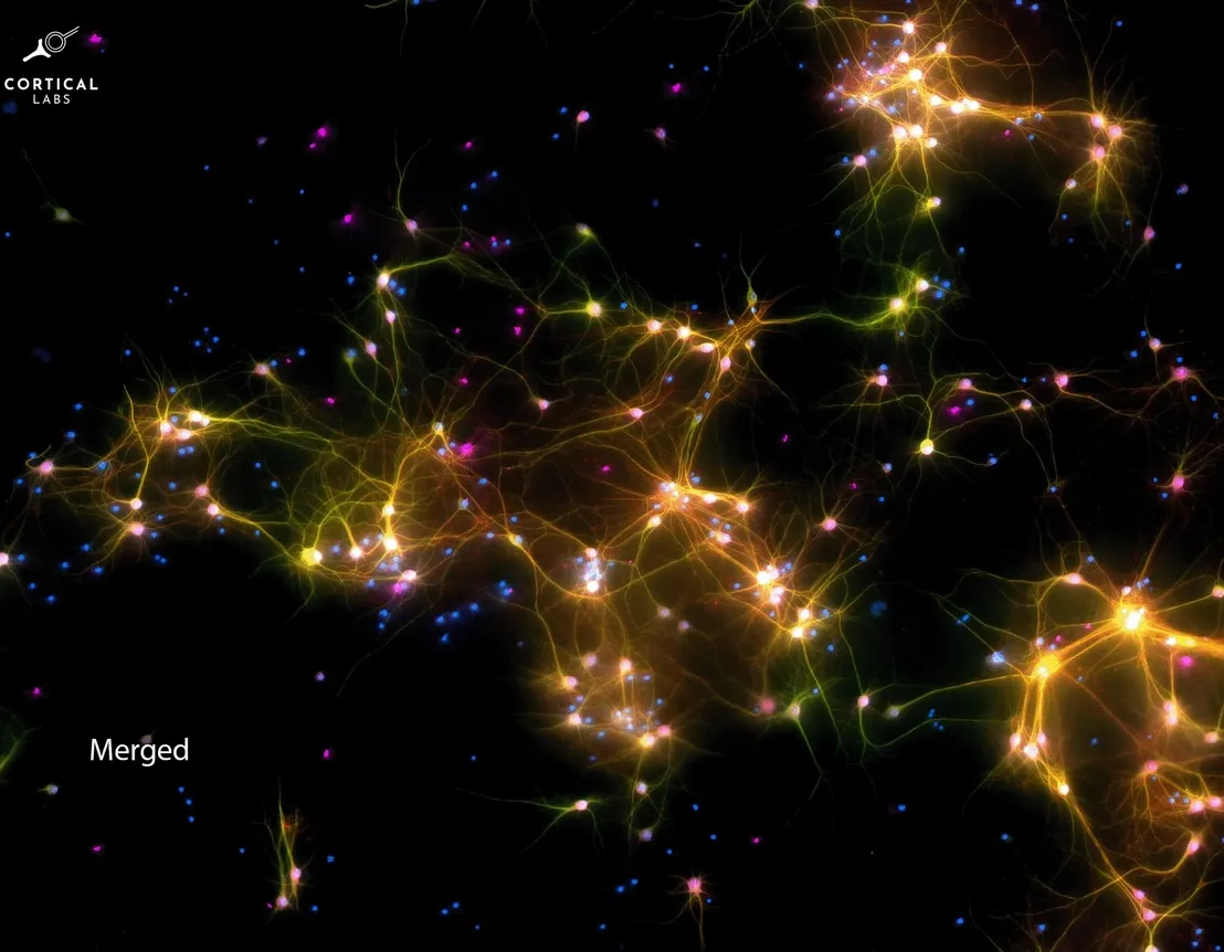 Микроскопический снимок нейронов в DishBrain.