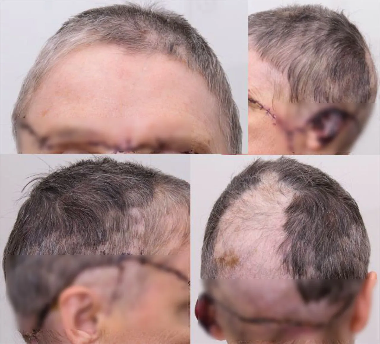 У женщины полностью зажили все повреждения.