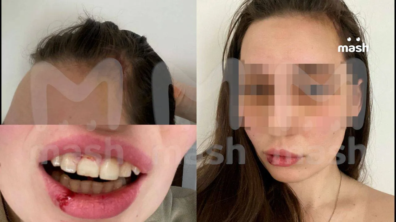 Вторая участника конфликта Алена 