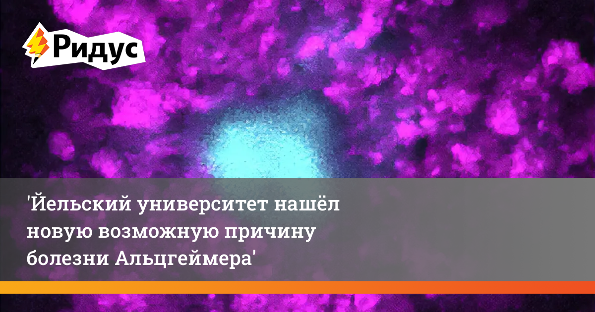 Йельский университет нашёл новую возможную причину болезни Альцгеймера