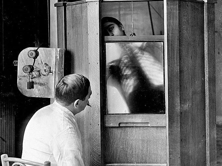 Старые рентгеновские аппараты использовали специальные экраны.