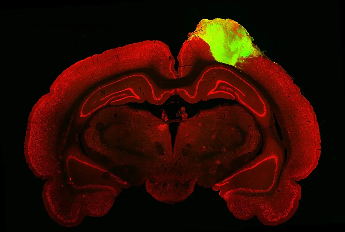 Зелёным цветом показаны человеческие органоиды, а красным - остальной мозг крысы.