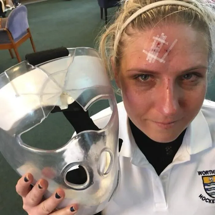 Поэтому хоккеисты носят маски.