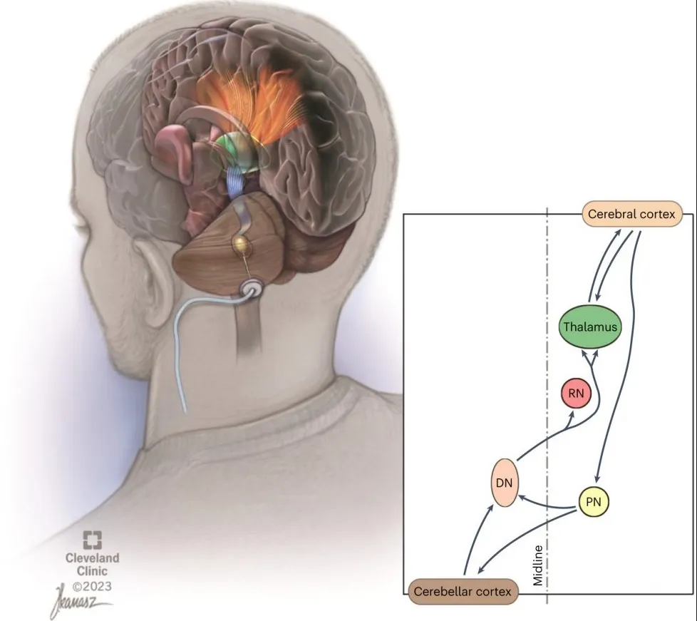 Принцип работы устройства довольно прост.