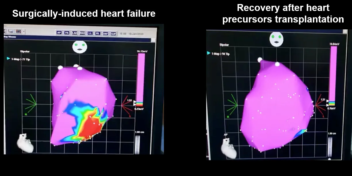 Сердце свиньи до и после трансплантации стволовых клеток-предшественников. Области фиолетового цвета представляют собой здоровые ткани, а области других цветов — поврежденные ткани. 