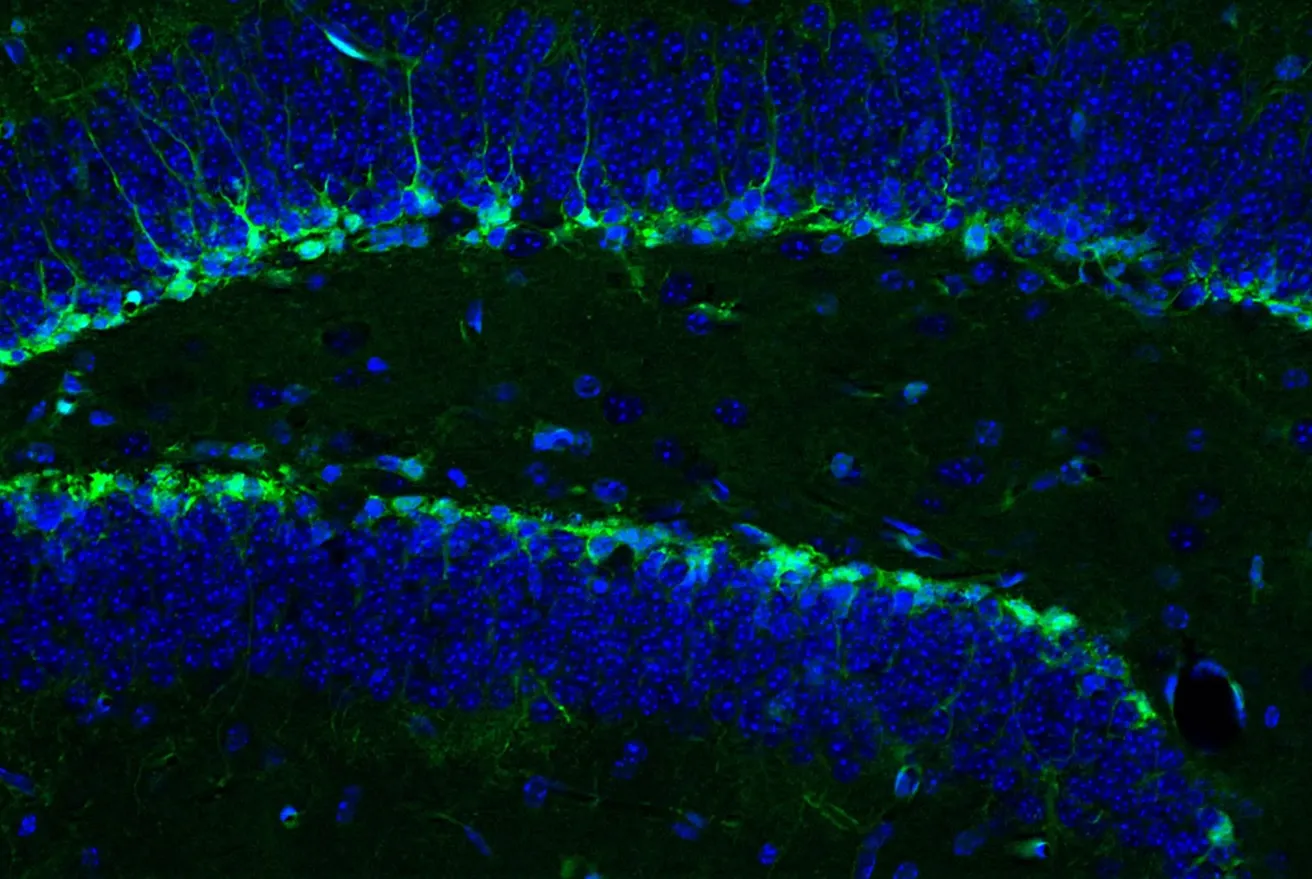 Новое вещество способно восстанавливать функцию гиппокампа не хуже спорта.